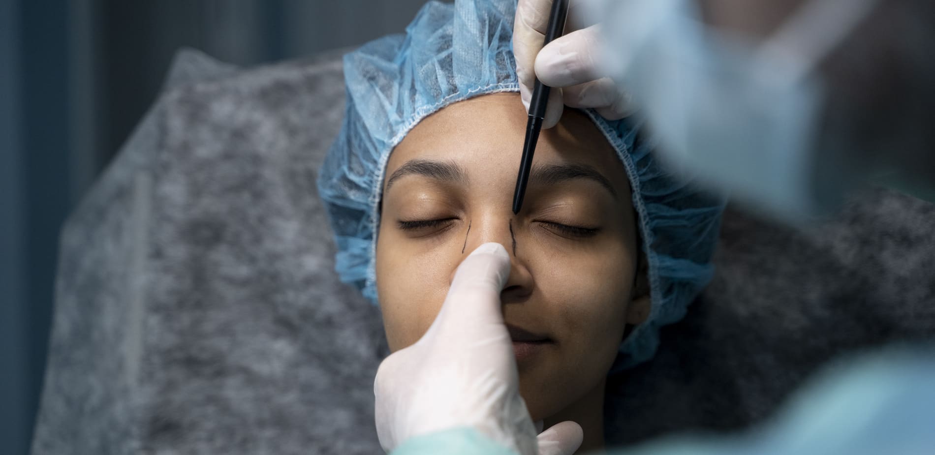 How painful is rhinoplasty and what does recovery feel like?