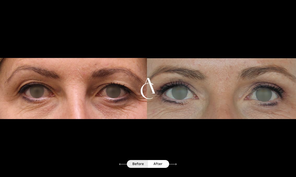 TP – Plastic surgery face – 1 TP – Plastic surgery face – 1