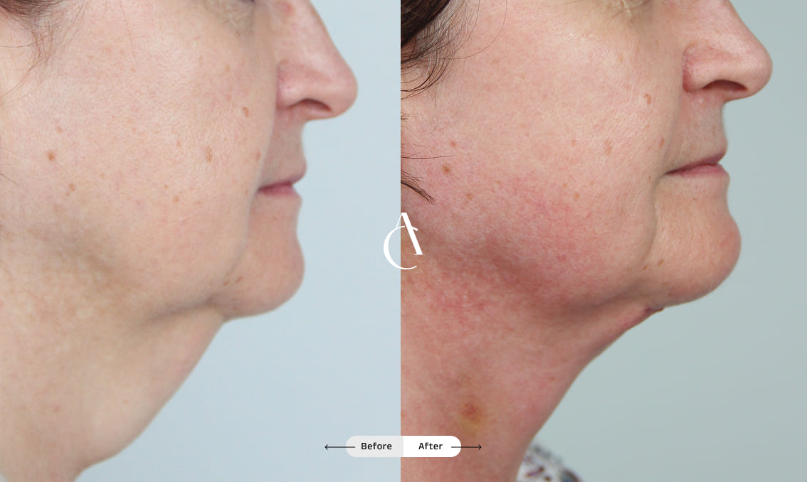 TP – Plastic surgery face – 10 TP – Plastic surgery face – 10