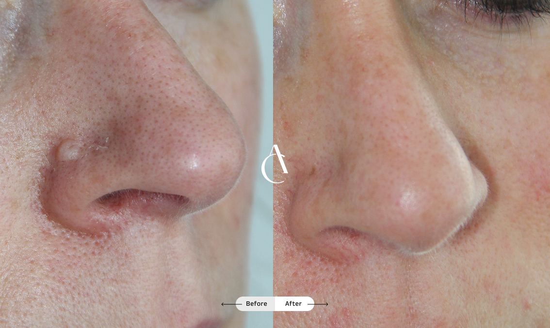 TP – Plastic surgery face – 15 TP – Plastic surgery face – 15