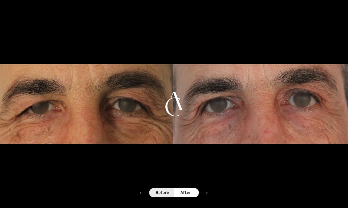 TP – Plastic surgery face – 17 TP – Plastic surgery face – 17