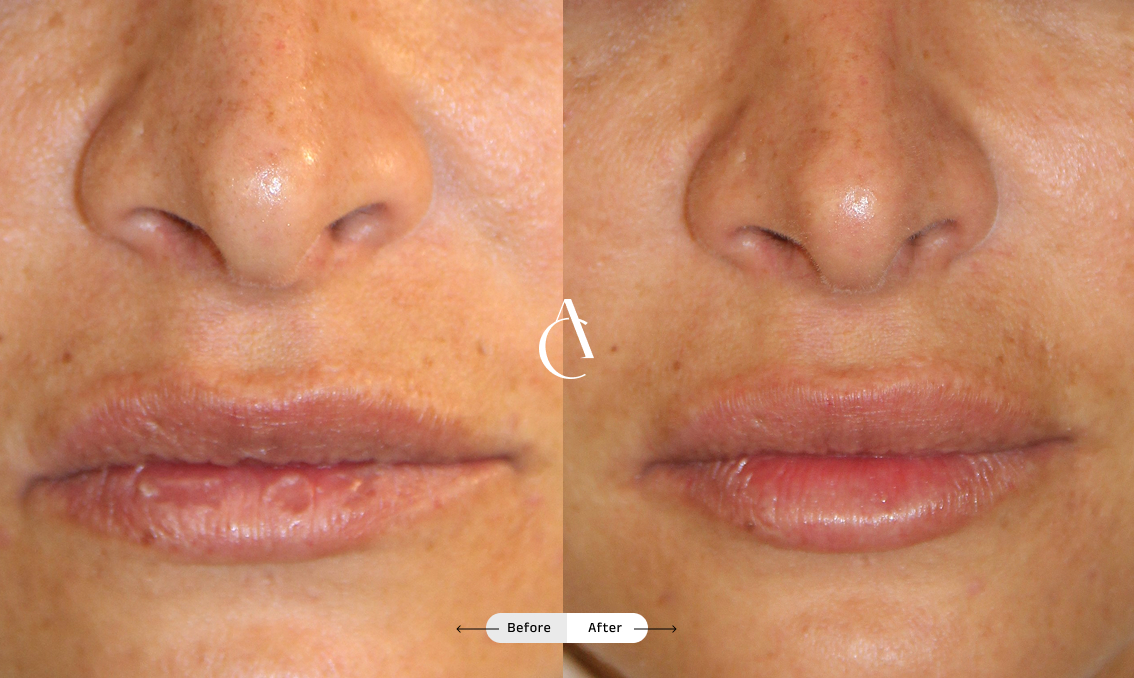 TP – Plastic surgery face – 5 TP – Plastic surgery face – 5