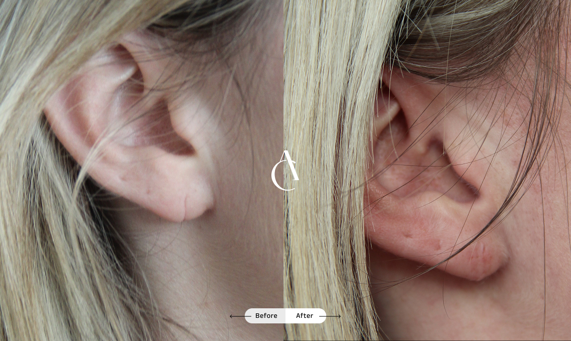 TP – Plastic surgery face – 7 TP – Plastic surgery face – 7