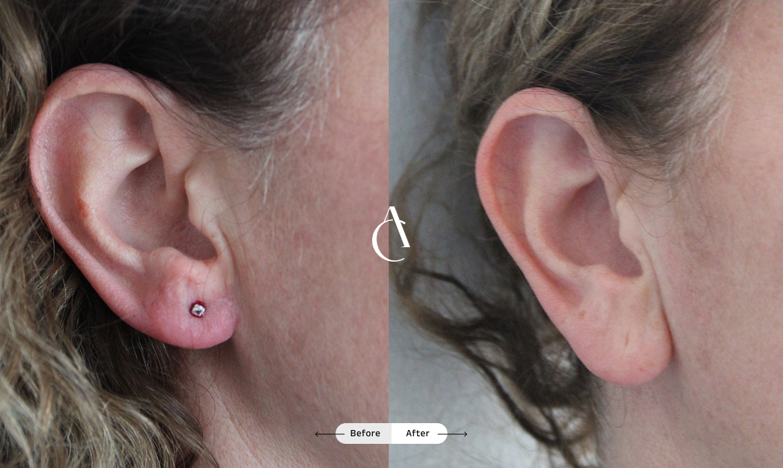 TP – Plastic surgery face – 9 TP – Plastic surgery face – 9