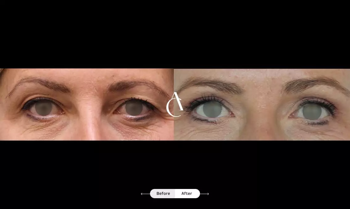 TP – Plastic surgery face – 1 TP – Plastic surgery face – 1