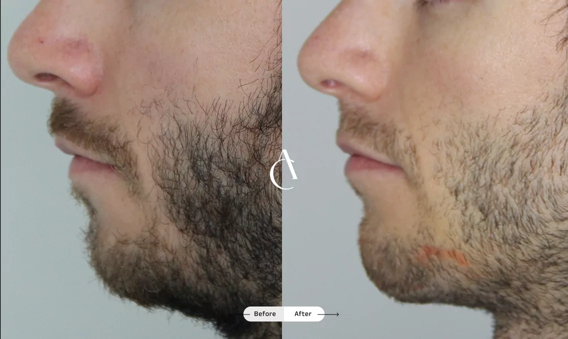 TP – Plastic surgery face – 3