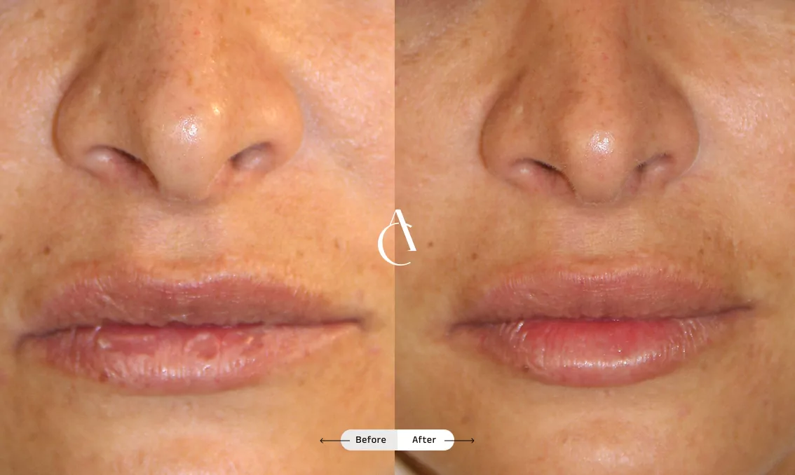 TP – Plastic surgery face – 5 TP – Plastic surgery face – 5