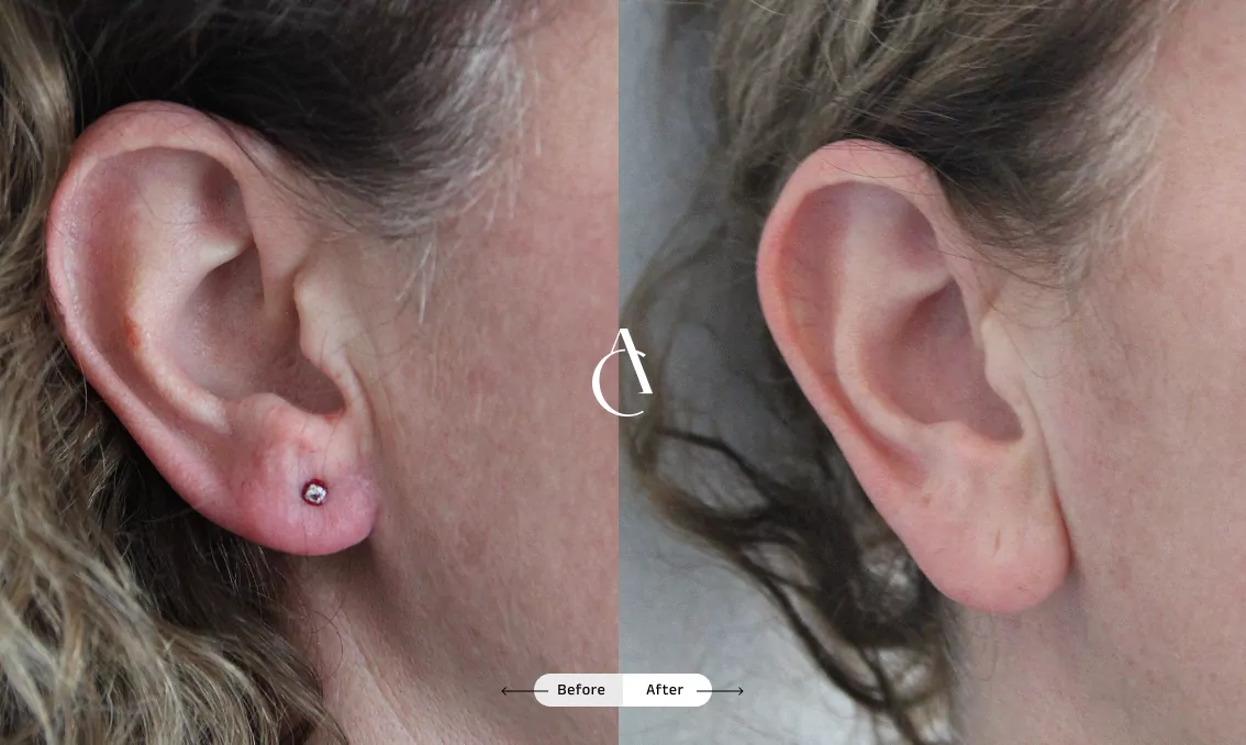 TP – Plastic surgery face – 9 TP – Plastic surgery face – 9